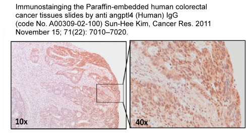 anti angptl4 antibody for immunohistochemistry a00390-02-100 from aviscera bioscience