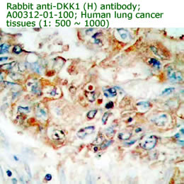 anti human DKK1 antibody