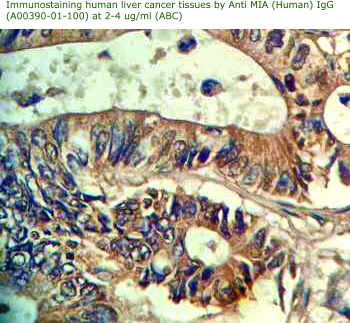 Anti human MIA antibody enables to detect MIA on immunohistochemistry
