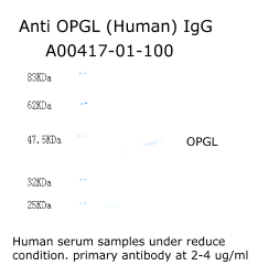 anti OPGL antibody from aviscera bioscience